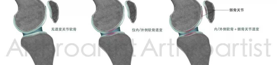 圖片11.png